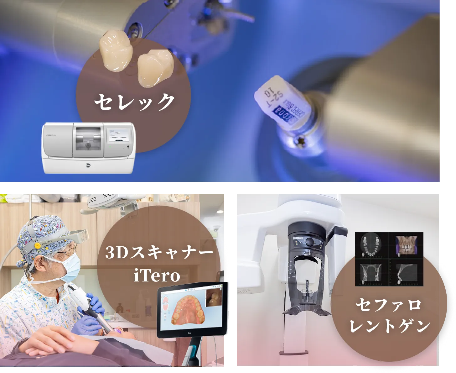 セレック、３DスキャナーiTero、セファロレントゲン
