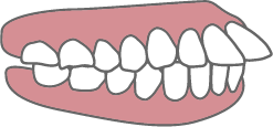 出っ歯イラスト