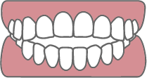 開咬イラスト