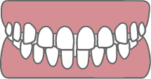 すきっ歯イラスト